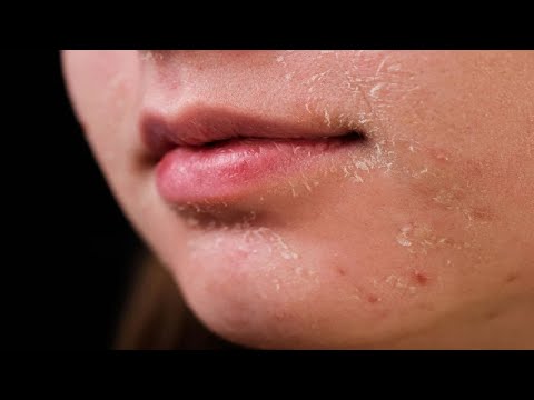 Dry Skin Remedies | 5 Home Remedies For Dry Skin On Face | Top 5.