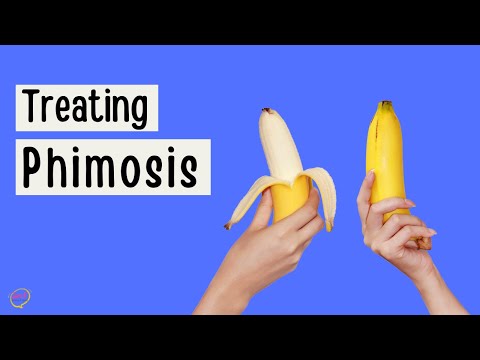 How to deal with a tight foreskin | Phimosis treatment