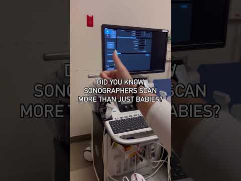 Did you know sonographers scan more than just babies? #shorts