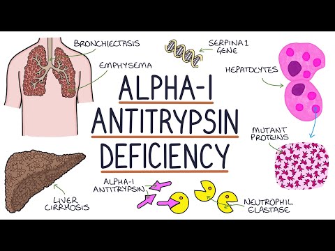 Understanding Alpha-1 Antitrypsin Deficiency