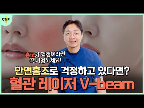 나에게도 주변에서도 흔히 나타나는 안면홍조를 치료할 V-Beam 혈관 레이저!