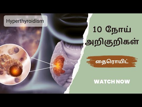 Thyroid symptoms in tamil/Hyperthyroidism symptoms in tamil/thyroid problems in women tamil/TSH Test