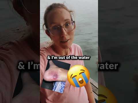 #islandlife pregnant with a spider bite 😭 #offgrid #shortsvideo