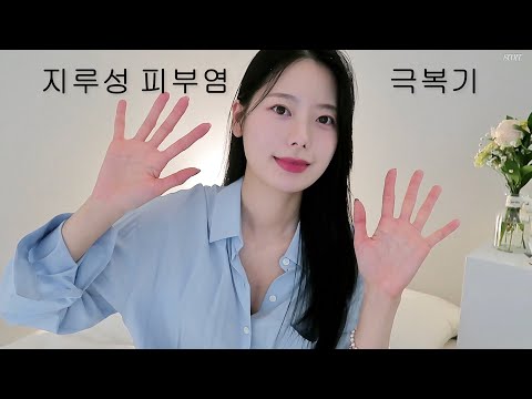 지루성 피부염을 완치한 4가지 방법ㅣ완치  3년 이상 유지 방법ㅣ피부 좋아지는 법 Q&A 12가지ㅣ증상별 극복 방법