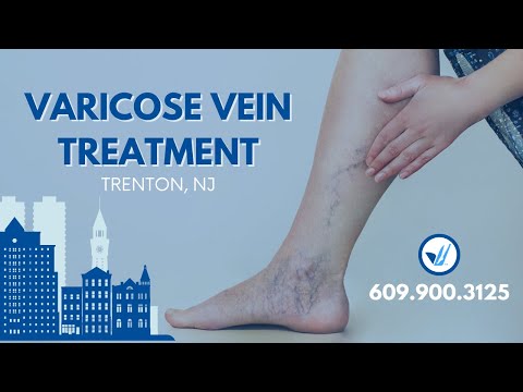 Varicose vein treatment in Trenton, New Jersey (NJ)