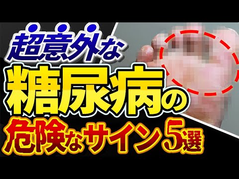 【放置厳禁！！】絶対見逃してはいけない糖尿病の危険な初期症状5選について医師が解説しました。