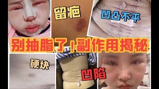 答应我别抽脂了：留疤/变形/凹凸不平/硬块/反弹30斤/松弛/下垂/无知觉/抽脂/面吸/面部吸脂/胳膊环吸/大腿环吸/腰腹环吸/水动力吸脂/瘦身/瘦脸