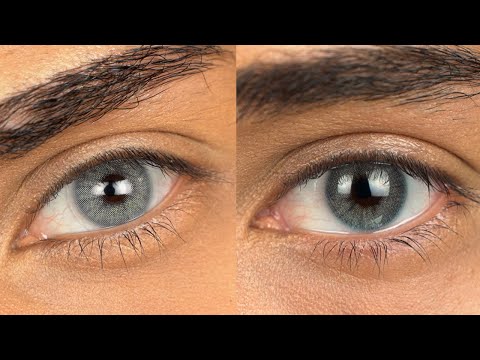 Natural Blue Colored Contact Lenses | Hidrocor Cielo VS Anesthetic Mar