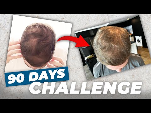 GROWBAND PRO - 90 Day Hair Growth Challenge