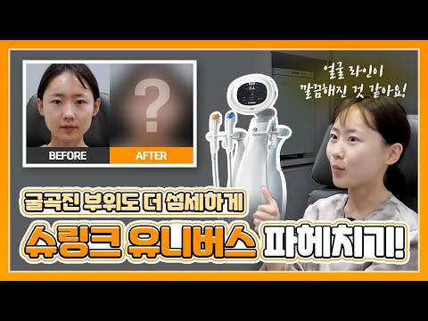 [밴스의원 강서화곡점] 굴곡진 부위도 더 섬세하게💖 슈링크 유니버스 김민수 대표원장님이 알려드립니다👍