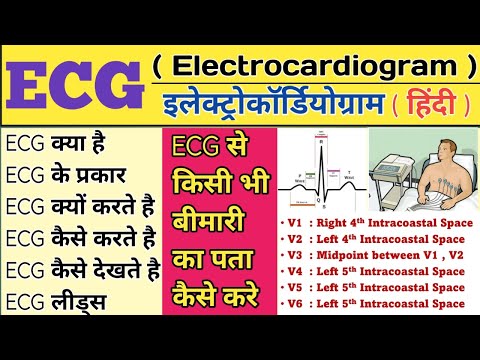 ECG | Electrocardiogram | ECG Test | ECG procedure | ECG Report | ECG Test Normal Report | ECG notes