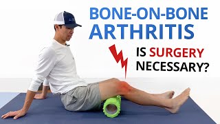 Bone on Bone (Osteoarthritis) Knee Pain Exercises & Treatment Options