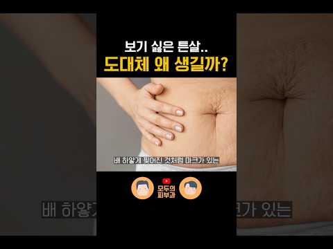 튼살이 생기는 4가지 이유