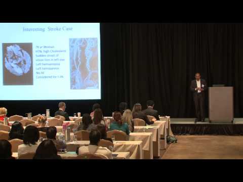 5th Annual Neuroscience Symposium | Dr. Srinath Kadimi | Cryptogenic Stroke