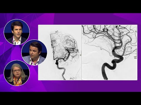 STRYKER symposium: Innovative aneurysm treatments