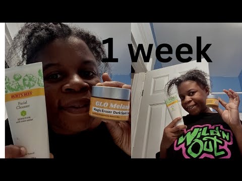 "Clearing the Way: Week 1 Acne Treatment Journey"