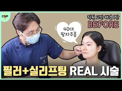 필러와 실리프팅으로 40대 팔자주름 시술과정 대공개! [직원 고민해결 1탄]