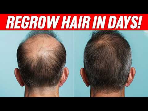 Stop Losing Hair! 🛑 5 Shocking Secrets to Boost Growth 🌱✨💇‍♂️#HairGrowth #HealthyHair #StopHairLoss