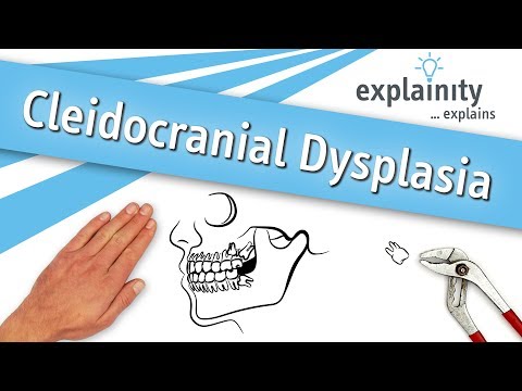 Cleidocranial Dysplasia explained (explainity® explainer video)