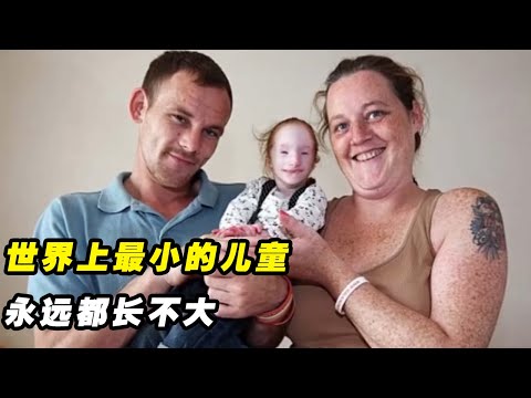 世界上最小的孩子，永远都长不大！2岁体重才达到7磅（纪录片）