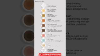 Urine Colour Chart #colour  #urinetest #urine_infection #urinary #urinecolour #prometricexam