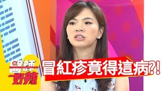 手腳突冒疹子！醫:當心變成 「蜂窩性組織炎」？！醫師好辣 20180814 part4 EP587 朱芯儀 江坤俊