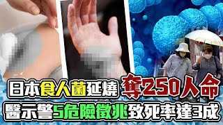 日本食人菌延燒「奪250人命」 醫示警「5危險徵兆」致死率達3成 @ChinaTimes