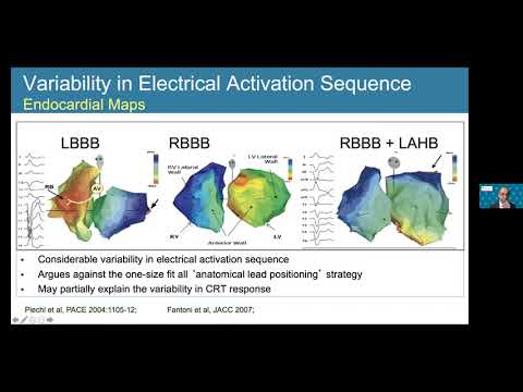 Schulich Heart Program Grand Rounds – Advances in Electrical Therapies for Heart Failure