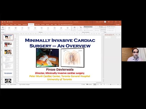 Schulich Heart Program Grand Rounds – Minimally Invasive Cardiac Surgery - An Overview