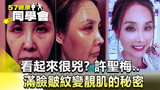 看起來很兇？許聖梅  滿臉皺紋變靚肌的秘密【@57healthy 】2024.12.07｜張予馨 、鄒玉樹、莫芳、莊斯棋、許聖梅