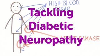 Minute Lectures: Tackling Diabetic Neuropathy.