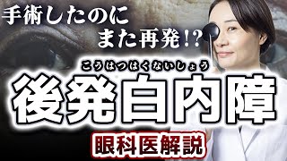 後発白内障の初期症状・時期・原因・レーザー手術治療を眼科医が解説