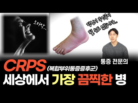 세상에서 가장 고통스러운 병 CRPS를 예방하는 단 한가지 방법 (feat. 여러분도 절대 자유로울 수 없습니다)