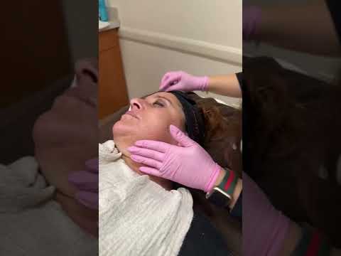 Live dermaplaning demonstration on patient - Open house 2022