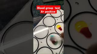 Blood group test #complete #art #bloodcount #egg #love #preparewiththebestrockthetest #short #viralv