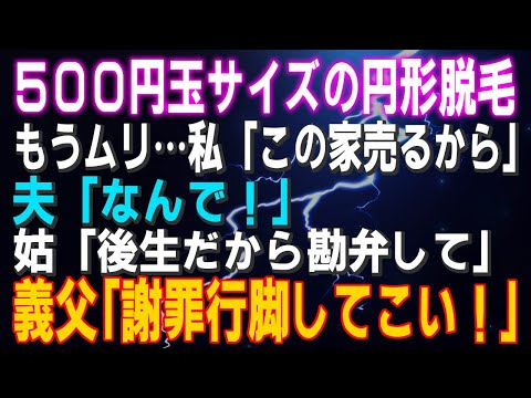 【スカッとする話】５００円玉サイズの円形脱毛 もうムリ…私「この家売るから」夫「なんで！」姑「後生だから勘弁して」義父「謝罪行脚してこい！」結果