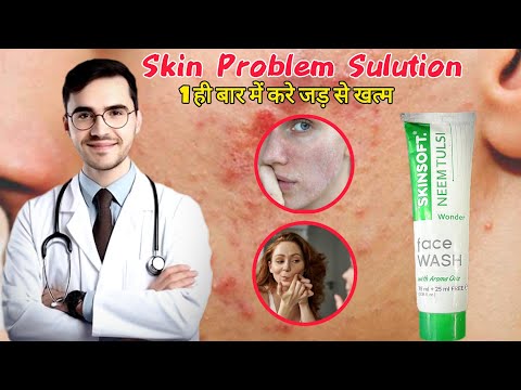 Pimples, Dry Skin, Acne Problems Solution ✅ | 💥 Dry Skin Winter Care | Winter Skin Care Face Wash