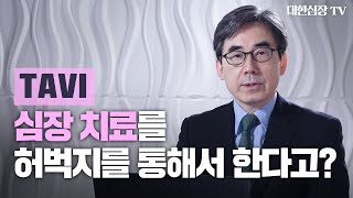 [TAVI①: 강연편]경피적 대동맥판막 삽입술은 무엇인가?