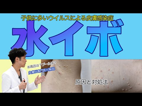 子供に多いウイルス性イボ！水イボの原因と対策