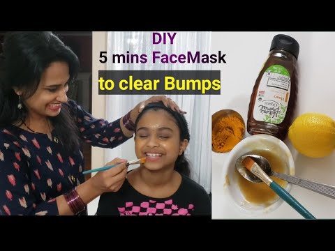 DIY Honey Turmeric face mask to clear bumps / acne on skin | Get glowing skin in 5 minutes