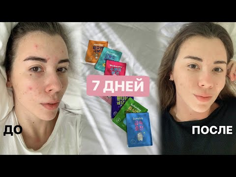 Чистая кожа за 7 дней | НЕДЕЛЬКА МАСОК, питание, спорт