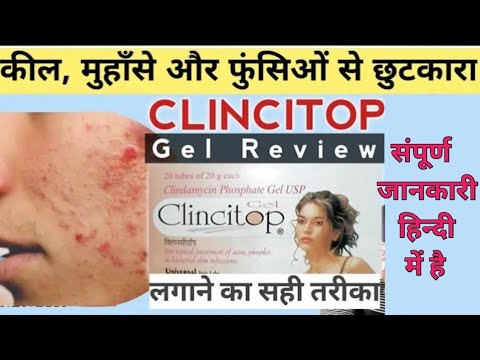 clincitop gel review || price || sideeffects || how to use clincitop gel #cngajbhiye #clincitopgel