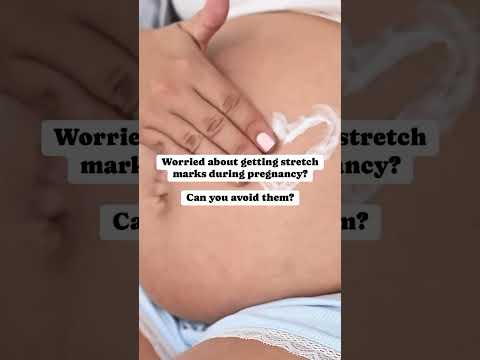 Worried about stretch marks? Can you avoid them? #pregnancyjourney #pregnant #momtobe