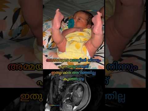 പുറത്ത് വന്നത് ഇതുവരെ അറിഞ്ഞില്ല 🤰🤰😂😂#youtubeshorts #baby #pregnancy #shorts #postpartum