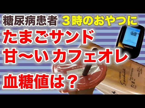 【糖尿病 食事】おやつに玉子サンドと【甘〜い】カフェオレを食べて血糖値測定結果は？♯18