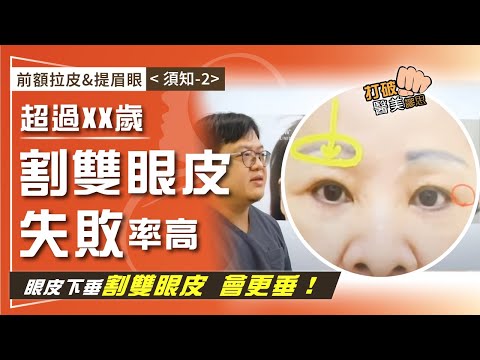 前額拉皮&提眉眼（須知-2）眼皮下垂選擇割雙眼皮 錯了嗎？ 專家警告：超過XX歲 割雙眼皮當心嚴重眉壓眼 打破醫美謬思334-20241203