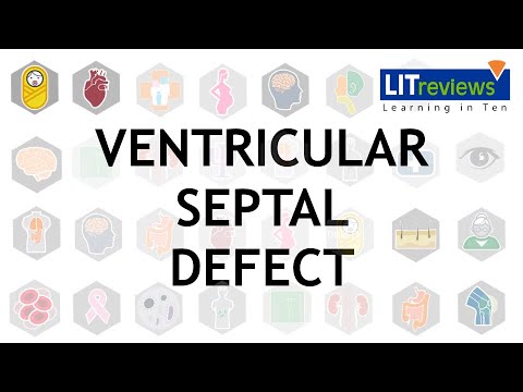 Ventricular Septal Defects - Duke-NUS Medical School