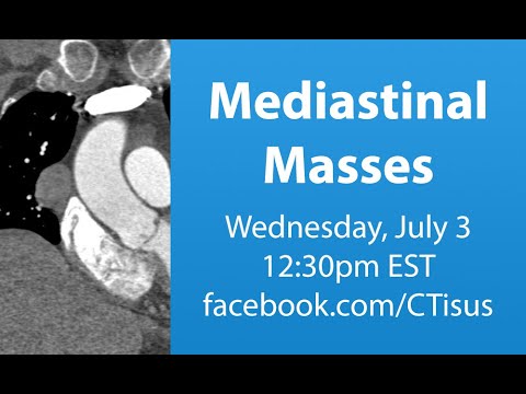 Facebook Live: Mediastinal Masses