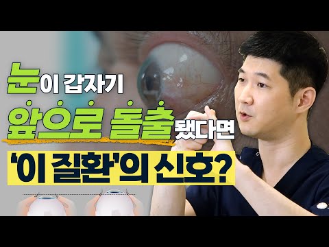 눈이 앞으로 돌출되는 안구돌출, 다양한 원인부터 치료법까지! - 솔직한 안과 #16