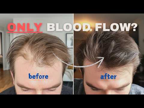 Does MORE BLOOD FLOW Increase Hair Growth?